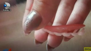 Cum să te fereşti de ţeapa faţetelor dentare! Şocant, ce a păţit o mămică din Piteşti