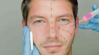 Barbatii ajung din urma femeile cand vine vorba despre interventii estetice!