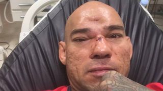 Imagini greu de suportat! "Este cea mai dura lovitura de MMA pe care am vazut-o in ultimii 20 de ani". I-a spart capul la propriu