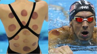 Ventuzele sunt cele care le provoaca vanataile sportivilor americani de la Rio