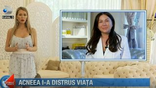 Acneea i-a distrus viata! A gasit singura formula care sa o vindece. Care este secretul vedeti la "Codul Fericirii"