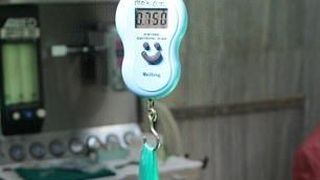 Cantarea doar 30 de kilograme la 20 de ani, iar medicii au operat-o de urgenta. Au fost ingroziti de ce au gasit in stomacul tinerei