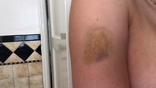 Un actor celebru si-a snopit in bataie iubita! Fata a fost lovita cu pumnii si cu picioarele si aruncata pe scari! Imaginile cu ea plina de vanatai sunt socante!