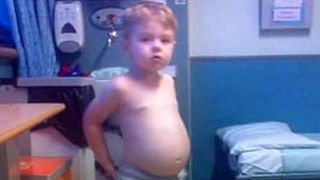 Parintii lui credeau ca s-a ingrasat de la dulciuri, dar cand au aflat ce are baietelul in burtica au fost devastati