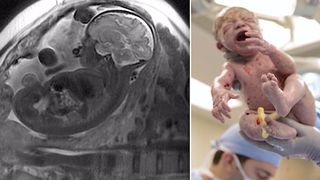 A nascut un baietel perfect sanatos, dar cand medicii i-au vazut placenta au fost socati si i-au bagat-o la loc in abdomen!