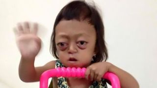 A nascut o fetita cu dizabilitati si a vandut-o, ca sa scape de ea. Ce s-a intamplat cu micuta este sfasietor