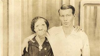 Povestea fabuloasa a femeii poreclite "fata de magar"! Era considerata cea mai urata femeie din lume, dar s-a casatorit cu un barbat superb! Tanarul o iubea enorm