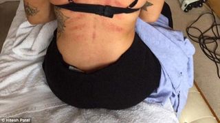 Nu a fost lovita si nici nu a suferit un accident rutier, ci serviciul ii provoaca aceste urme. Nu o sa va vina sa credeti cu ce se ocupa aceasta femeie