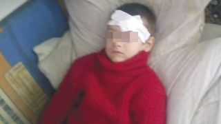 Cumplit! Si-a mutilat copilul cu fierul de calcat fiindca nu ii spune mama - Medicii din Barlad s-au ingrozit cand au vazut ranile