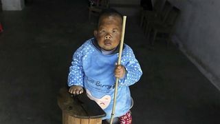 Barbatii de varsta lui sunt casatoriti si au si copii. Nimeni nu isi poate explica de ce acest om nu a mai crescut de la varsta de 2 ani