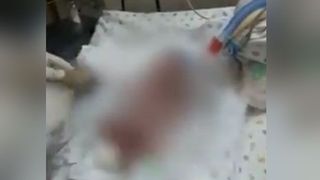 Un prematur declarat mort la nastere si-a revenit miraculos cu scurt timp inainte de inmormantare