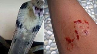 Un baietel de 14 ani a fost muscat de o cobra, iar apoi a postat imaginile pe Facebook. Ce-a urmat apoi e dureros