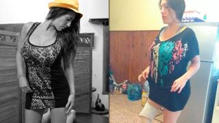 A vrut să fie mai slabă şi a decis să-şi facă o liposucţie, &icirc;nsă a ajuns să-i fie amputat piciorul! Povestea cumplită a unei tinere de 31 de ani