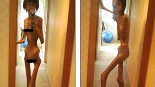 Infometata si abuzata de propriul bunic! Cantarea numai 17 kilograme cand a fost salvata - Cum arata tanara acum