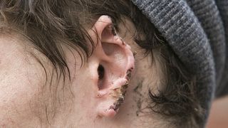 Caz socant de canibalism la Vaslui! Un barbat i-a devorat urechea unui prieten!