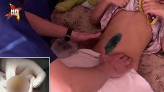 O fetita de 10 ani acuza dureri cumplite de stomac! Cand au vazut ce se afla in abdomenul micutei, medicii au ramas muti