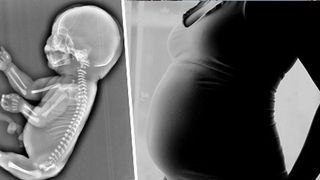 Este socant ce a adus pe lume o tanara de 25 de ani. A trait doar 15 minute, iar medicii nu au putut sa ii determine sexul