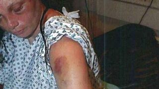 Gravida batuta cu ciocanul de tatal copilului! Ororile nu s-au oprit aici. Femeia a trecut prin chinuri groaznice ore in sir. Cel mai oribil caz de violenta