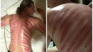 Aşa arată spatele unui bărbat după ce şi-a făcut masajul "dragonul roşu": "Mi-a plăcut la nebunie! Nu mai simt nicio durere acum!"