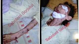Imaginile groazei &icirc;ntr-un azil de bătr&acirc;ni din Gorj! O femeie de 77 de ani, &icirc;n stare gravă, după ce a fost muşcată de şobolani