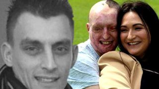 Daniel Rotariu, rom&acirc;nul desfigurat cu acid sulfuric de fosta logodnică, str&acirc;nge bani să dea poliţia engleză &icirc;n judecată!