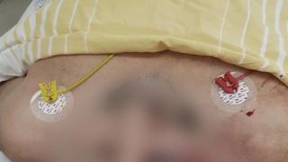 Ultimă oră! Politician &icirc;n stare gravă, după ce a fost bătut cu b&acirc;tele de lemn: "L-au lăsat inconștient, apoi l-au lovit cu picioarele"