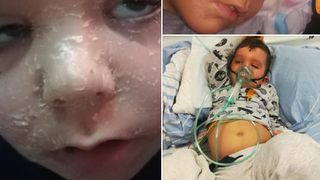 Denis, cobai pentru medicii din Capitală! Suferă de o boală rară, nedepistată, fiind tratat la &icirc;nt&acirc;mplare: "I se descuamează pielea, are dureri mari c&acirc;nd &icirc;și deschide ochii"