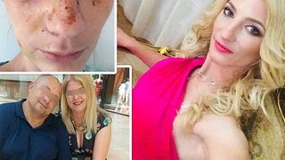 O t&acirc;nără de 27 de ani din Constanța, mutilată pe viață de un polițist băut!