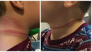 Băiețelul ei a fost la un pas de moarte după ce s-a jucat cu un obiect banal! O mamă a dezvăluit o poveste cutremurătoare