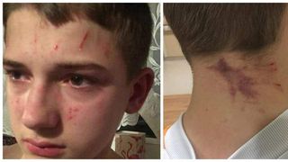 Mama lui Daniel e disperată! Colegii fiului ei l-au bătut până l-au băgat în spital! "Mi-a zis că se va sinucide pentru că ei nu se vor opri"