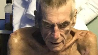 Drama trăită de acest bărbat e uriașă! A ajuns să cântărească 38 de kilograme, e bolnav, dar Statul îl OBLIGĂ să muncească!