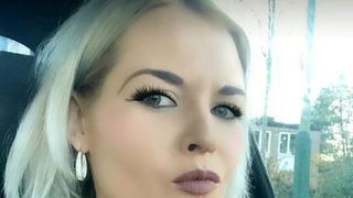 A fost desfigurată de iubit! Rudele ajunse la spital nu au mai recunoscut-o. A agresat-o după ce a a primit un prieten &icirc;n vizită