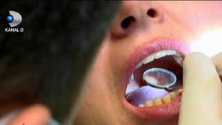 Stomatologii cer sa aiba dreptul sa faca injectii cu acid hialuronic sau botox