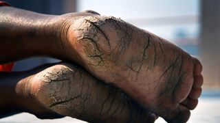 Continua descoperirile socante de la azilul privat din Timis. Ce spun medicii despre pacientii ajunsi la ei!