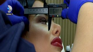 Romania, in topul tarilor cu cele mai multe operatii estetice! Peste 77.000 de interventii de infrumusetare, doar in 2017