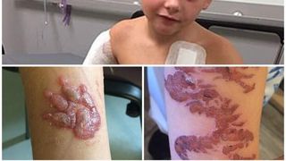 Părinți, aveți grijă! Și copilul dumneavoastră poate păți așa ceva! Un copil de șapte ani, mutilat după ce a făcut un lucru banal! "Am crezut că aceste lucruri sunt sigure!"