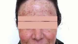 A ajuns să arate &icirc;n halul ăsta din cauza unui obicei pe care &icirc;l fac multe femei! Dacă și tu faci ASTA, OPREȘTE-TE!