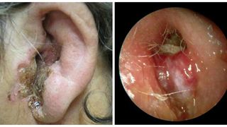 A contactat o boală teribilă din cauza unui obicei comun pe care &icirc;l face toată lumea! "Am trecut printr-un calvar!"