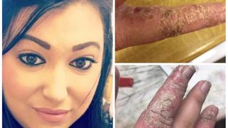 "Efectiv mi-au luat m&acirc;inile foc!" - Produsul care a distrus-o pe Francesca e preferat de rom&acirc;nce! Aveți mare grijă să nu pățiți la fel!