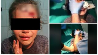 O copilă din Călărași, mutilată de patroana unui magazin! I-a spart un borcan cu bulion în cap pentru că a vrut o pungă de pufuleți! IMAGINI nerecomandate minorilor!