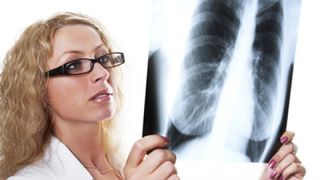 Cum arata viata unui bolnav de TBC in Romania! La ce riscuri se expun acesti pacienti?