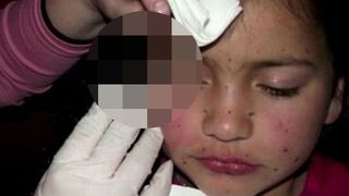 O mamă denaturată și-a mutilat fetița de doar 8 ani! Motivul halucinant pentru care &icirc;i injecta botox &icirc;n față