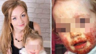 Te trec fiorii! O fetiță de 3 ani a fost la un pas de moarte după ce unul dintre apropiații familiei a pupat-o! Mama copilei avertizează toți părinții