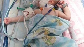 A murit bebelușul din Sebeș care s-a născut cu o malformație gravă