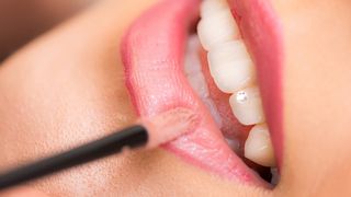 De ce s&acirc;ngerează gingiile? Cauze și soluții 