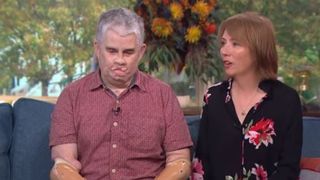 S-a dus la dentist, iar viața lui s-a schimbat radical! Când s-a trezit din comă toate membrele îi fuseseră amputate, iar fața îi era distrusă: „Fiica mea nu m-a recunoscut”