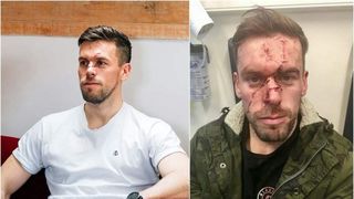 T&acirc;nar bătut măr cu o seară &icirc;naintea nunții. &rdquo;Mi-am pierdut ochii, mi-am ruinat nunta. Cariera mea a dispărut&rdquo;