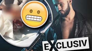 Imagini șocante cu Yamato Zaharia &icirc;n spital! Fostul faimos și-a tăiat m&acirc;na cu sabia! Cum a fost cusută rana la Urgențe! EXCLUSIV