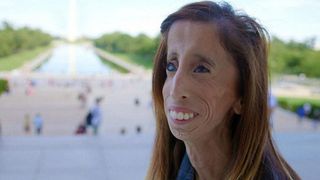 Cum s-a transformat "cea mai urâtă femeie din lume"