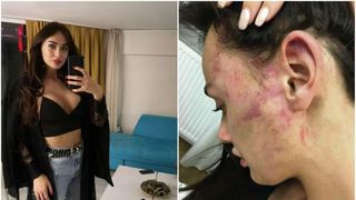 O super vedetă snopită în bătaie de iubit! „Am leșinat, m-a trezit și a continuat să mă lovească”